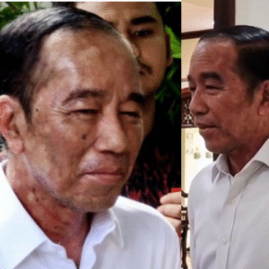 Jokowi sakit jokowi sakit apa pak jokowi sakit kabar terbaru kabar hype berita terbaru