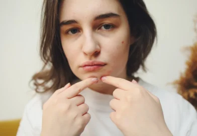 kenapa jerawat tidak kunjung hilang